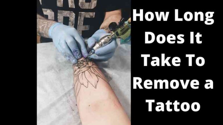 How Long Does It Take To Remove a Tattoo