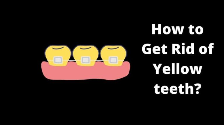 How to Get Rid of Yellow teeth