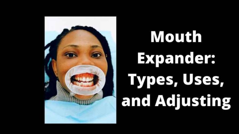 Mouth Expander: Types, Uses, and Adjusting