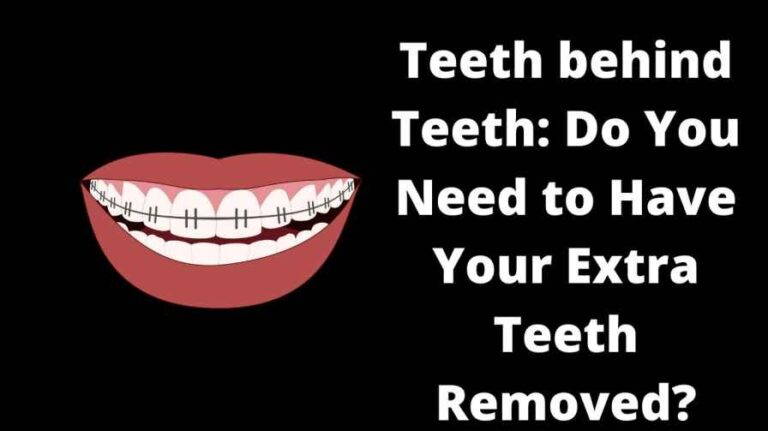 Teeth behind Teeth: Do You Need to Have Your Extra Teeth Removed