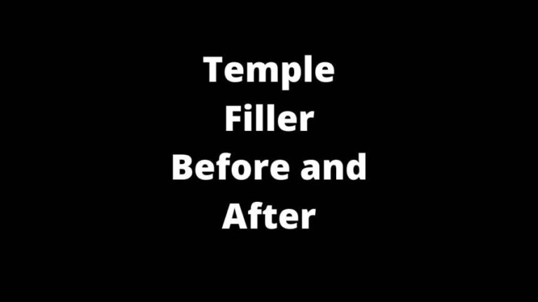 Temple Filler Before and After