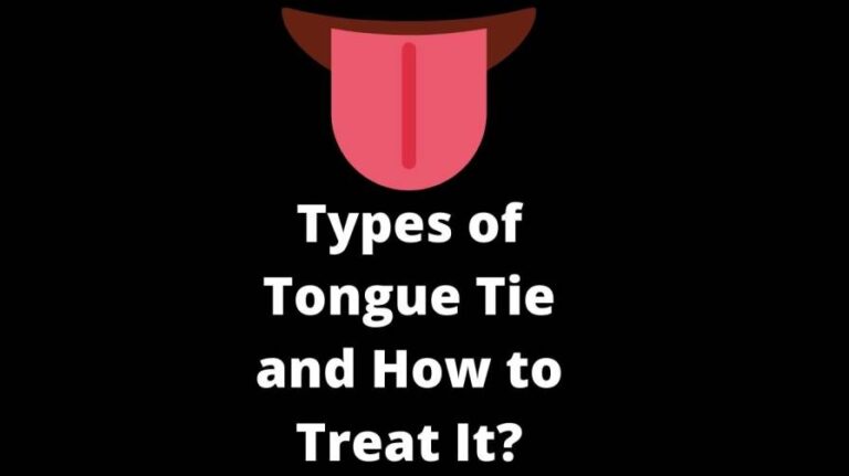 Types of Tongue Tie and How to Treat It?