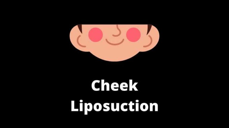Cheek Liposuction