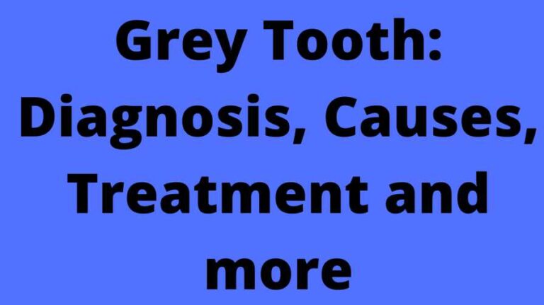 Grey Tooth: Diagnosis, Causes, Treatment and more