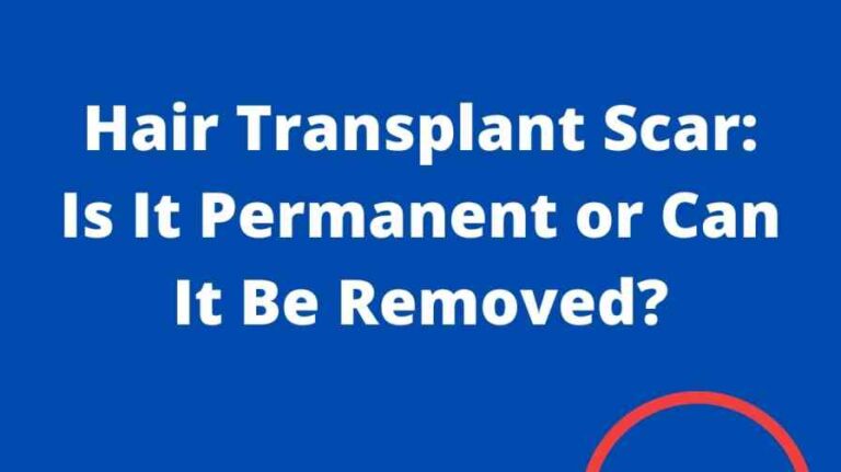 Hair Transplant Scar: Is It Permanent or Can It Be Removed?