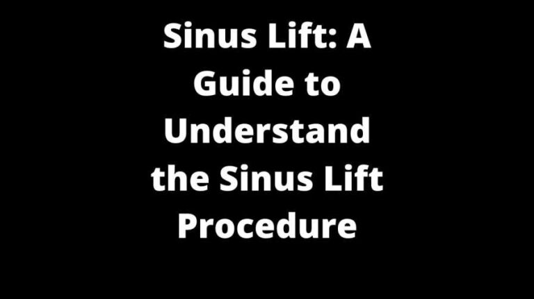 Sinus Lift: A Guide to Understand the Sinus Lift Procedure