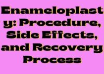 Enameloplasty: Procedure, Side Effects, and Recovery Process