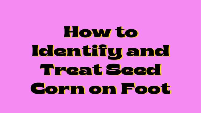 How to Identify and Treat Seed Corn on Foot