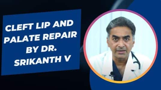 Cleft Lip and Palate Repair By Dr. Srikanth V