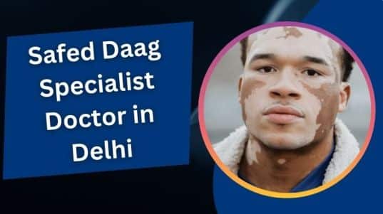 सफेद दाग स्पेशलिस्ट डॉक्टर इन दिल्ली | Safed Daag Specialist Doctor In Delhi